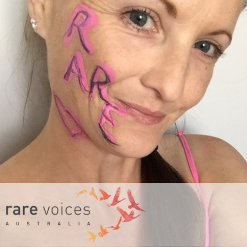 Jodie with words 'rare' painted on side of face