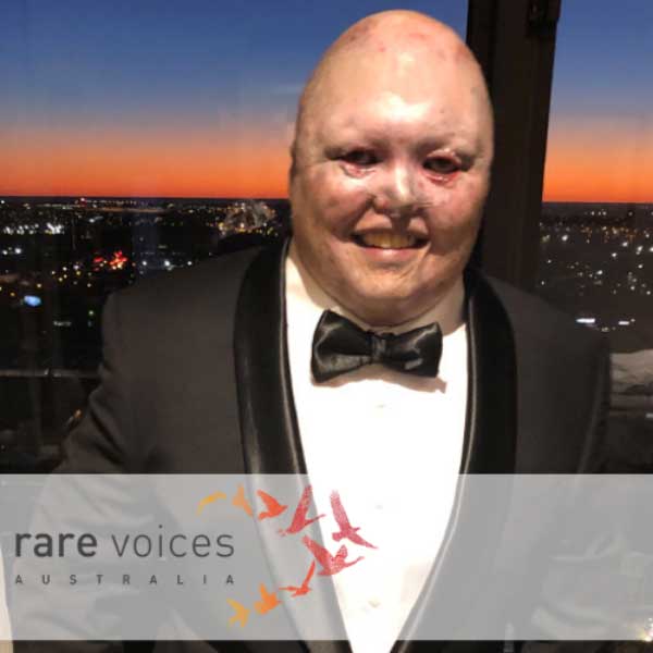 Dean’s-Story Photo of Dean wearing a suit and bow tie